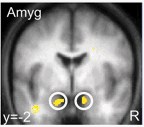 BRAIN DECISION MAKERS REWARD Accumbens 85 vs in ieder van ons ook bij mensen zonder bewuste racistische gevoelens wordt de amygdala actief bij het zien van een zwart gezicht De amygdala