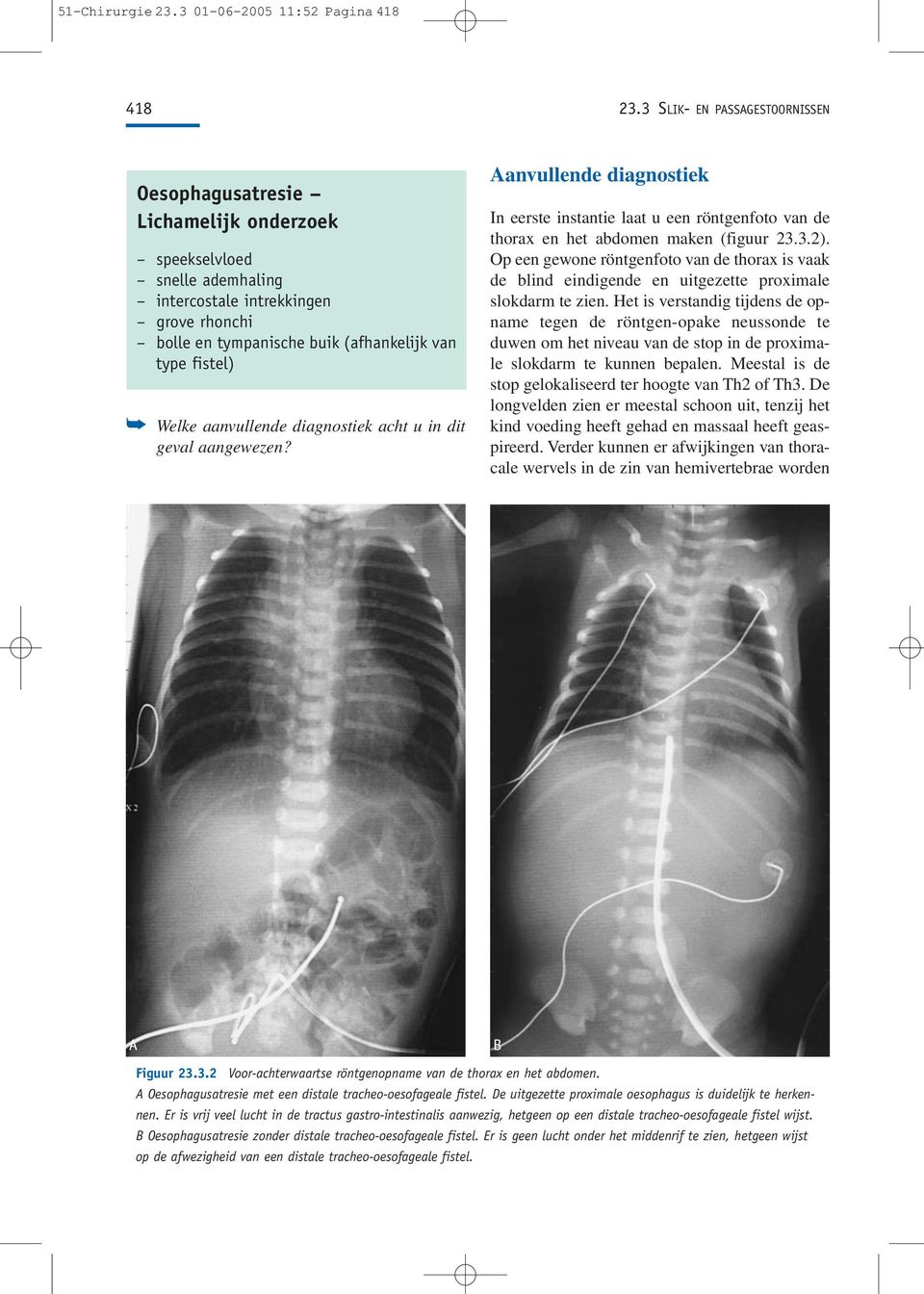Welke aanvullende diagnostiek acht u in dit geval aangewezen? Aanvullende diagnostiek In eerste instantie laat u een röntgenfoto van de thorax en het abdomen maken (figuur 23.3.2).