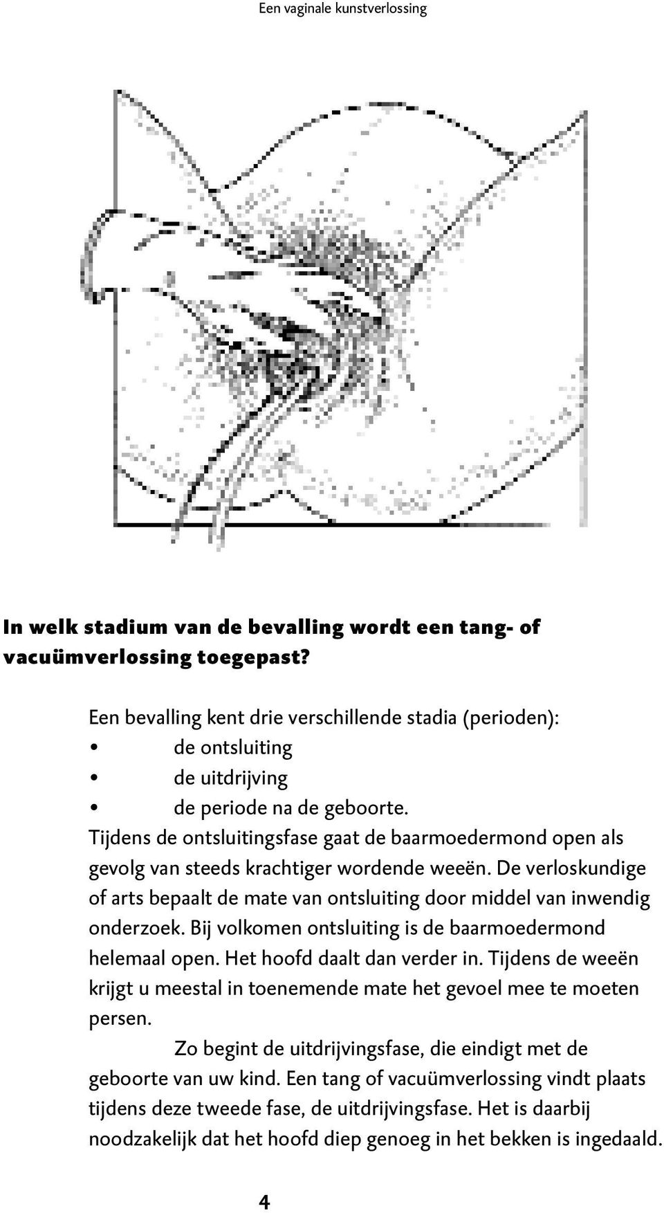 Tijdens de ontsluitingsfase gaat de baarmoedermond open als gevolg van steeds krachtiger wordende weeën. De verloskundige of arts bepaalt de mate van ontsluiting door middel van inwendig onderzoek.