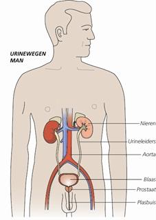 Chirurgisch verwijderen van de blaas (cystectomie) Normaal gesproken wordt de urine door de beide urineleiders naar de blaas getransporteerd en in de blaas opgeslagen.