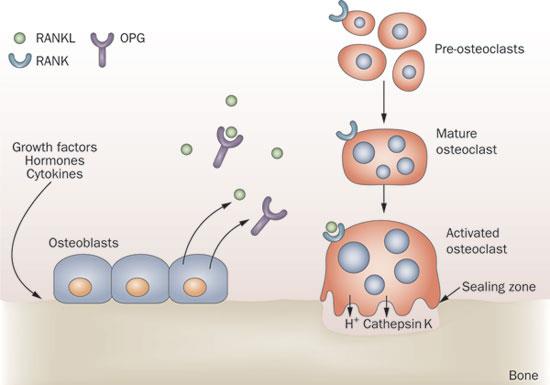 RANK-L/OPG en osteoclast OPG = osteoprotegerin RANK-L