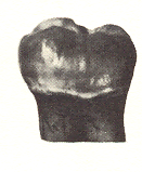 . Tandslijtage van een molaar, ongeschonden links, sterk afgesleten rechts Tandslijtage is vooral een goede indicator om mensen met een volgroeid definitief gebit onder te verdelen in jong of oud.