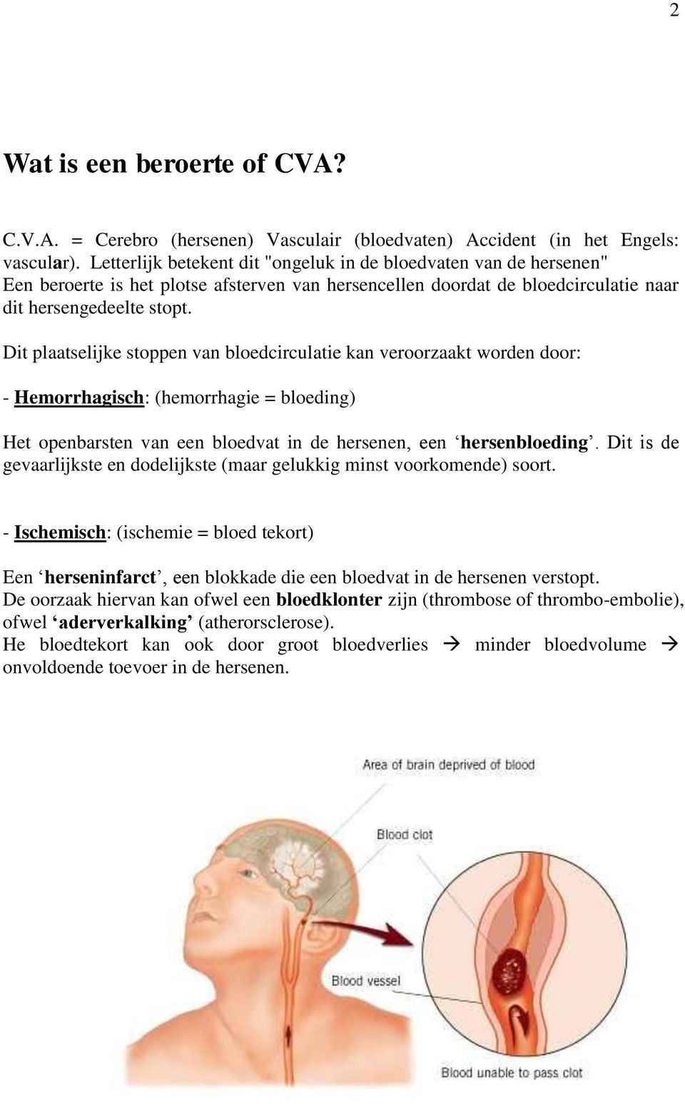 Dit plaatselijke stoppen van bloedcirculatie kan veroorzaakt worden door: - Hemorrhagisch: (hemorrhagie = bloeding) Het openbarsten van een bloedvat in de hersenen, een hersenbloeding.