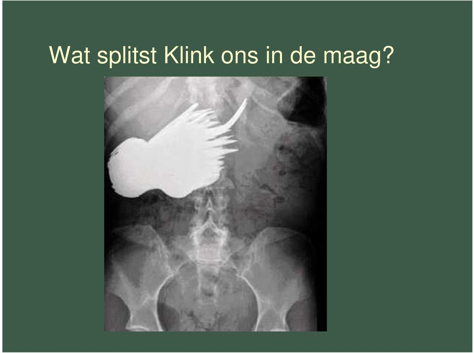 Klink ons