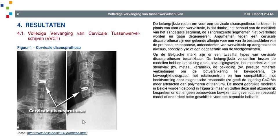 wervelfusie, is dat dankzij het behoud van de mobiliteit van het aangetaste segment, de aangrenzende segmenten niet overbelast worden en gaan degenereren.