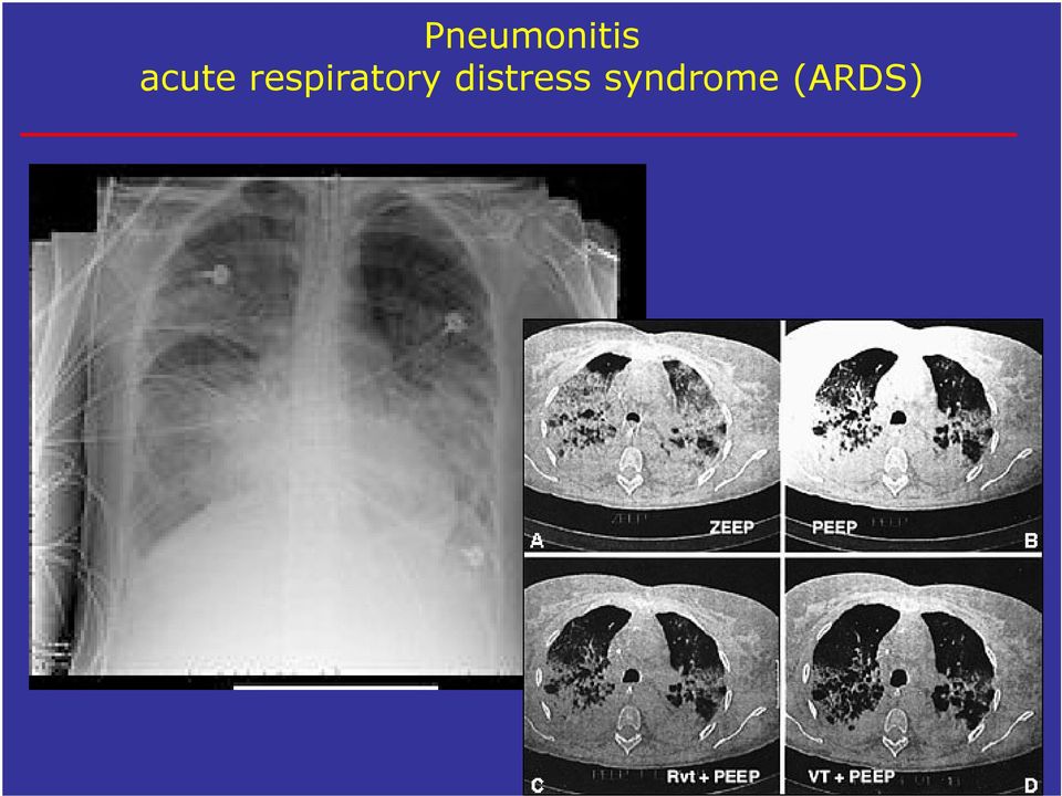 respiratory