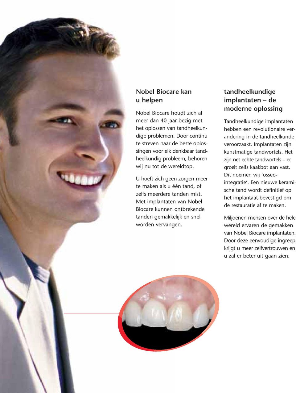 U hoeft zich geen zorgen meer te maken als u één tand, of zelfs meerdere tanden mist. Met implantaten van Nobel Biocare kunnen ontbrekende tanden gemakkelijk en snel worden vervangen.