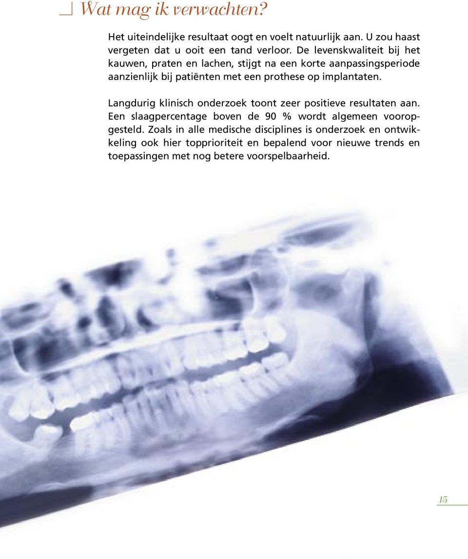 implantaten. Langdurig klinisch onderzoek toont zeer positieve resultaten aan. Een slaagpercentage boven de 90 % wordt algemeen vooropgesteld.