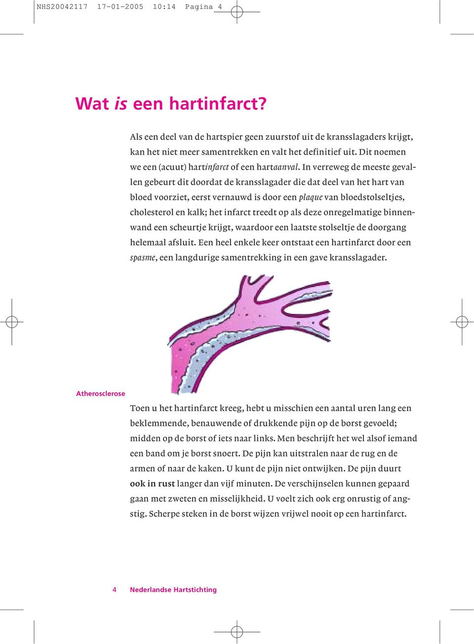 In verreweg de meeste gevallen gebeurt dit doordat de kransslagader die dat deel van het hart van bloed voorziet, eerst vernauwd is door een plaque van bloedstolseltjes, cholesterol en kalk; het