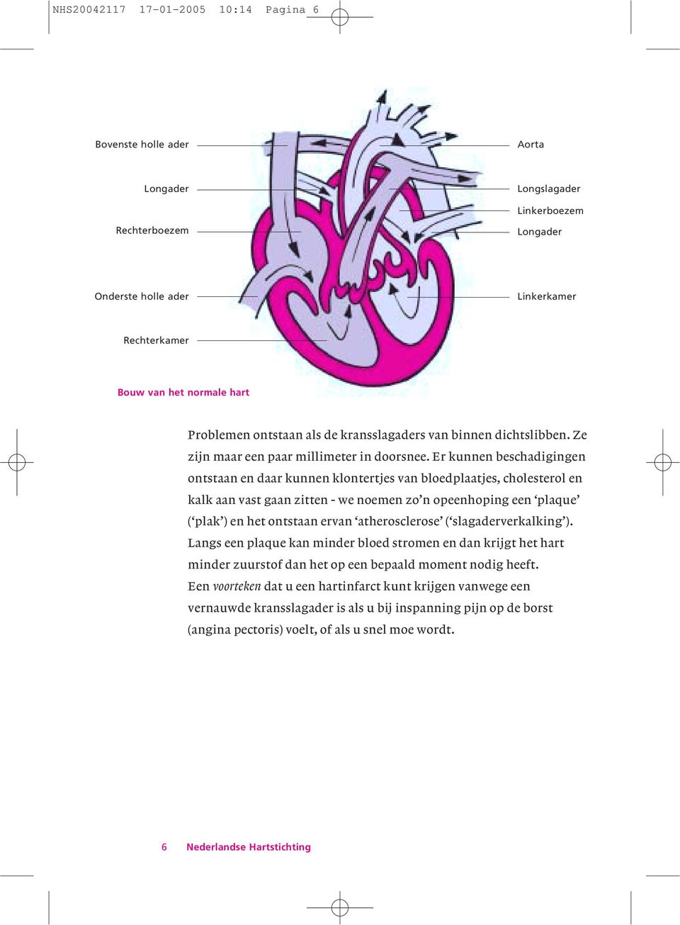 Er kunnen beschadigingen ontstaan en daar kunnen klontertjes van bloedplaatjes, cholesterol en kalk aan vast gaan zitten - we noemen zo n opeenhoping een plaque ( plak ) en het ontstaan ervan