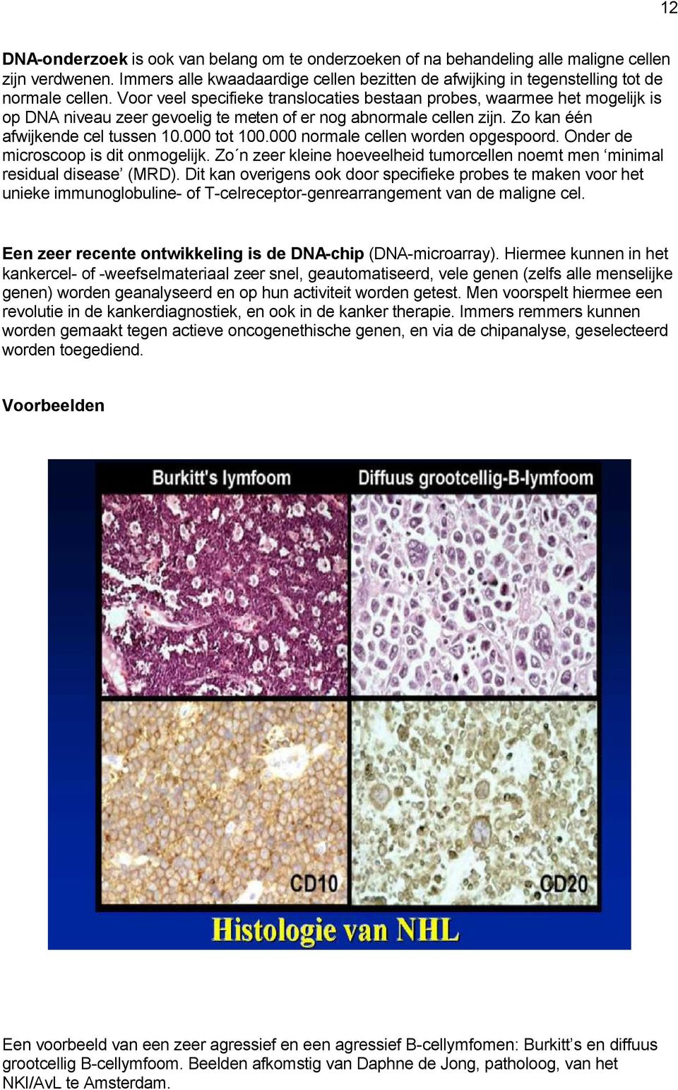 000 normale cellen worden opgespoord. Onder de microscoop is dit onmogelijk. Zo n zeer kleine hoeveelheid tumorcellen noemt men minimal residual disease (MRD).