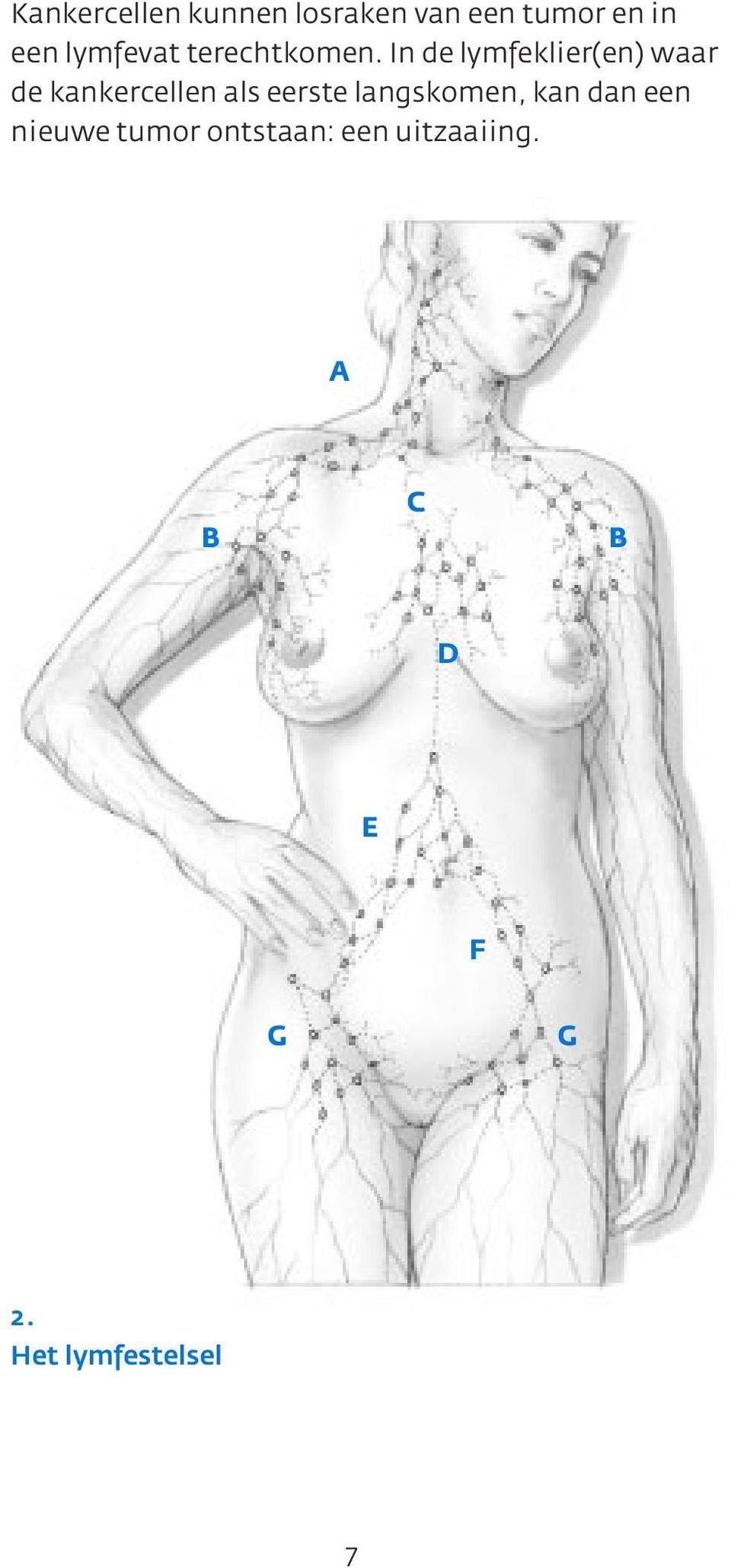 In de lymfeklier(en) waar de kankercellen als eerste