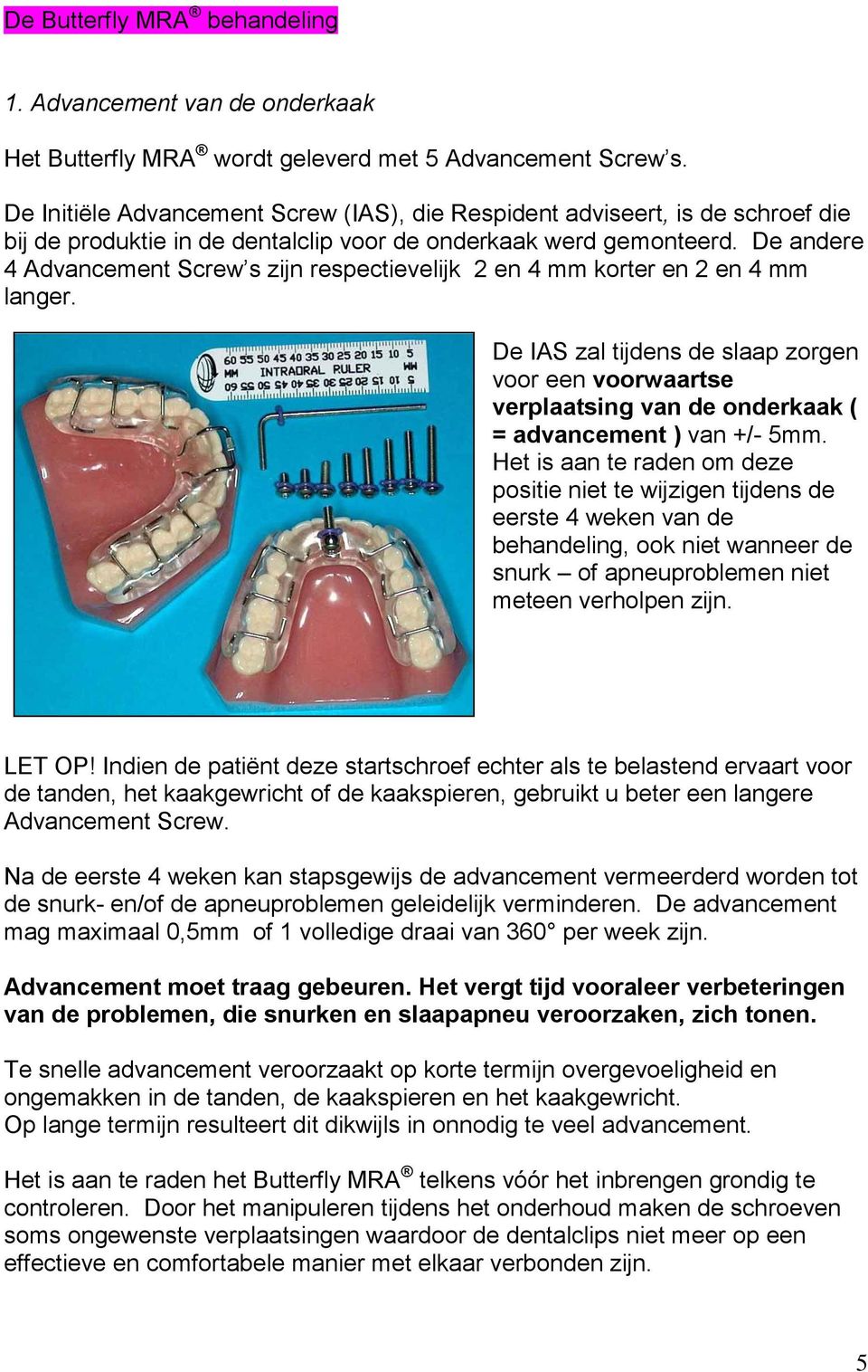 De andere 4 Advancement Screw s zijn respectievelijk 2 en 4 mm korter en 2 en 4 mm langer.