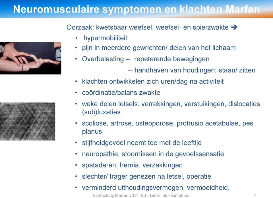 letsels: verrekkingen, verstuikingen, dislocaties, (sub)luxaties scoliose, artrose, osteoporose, protrusio acetabulae, pes planus stijfheidgevoel neemt toe met de