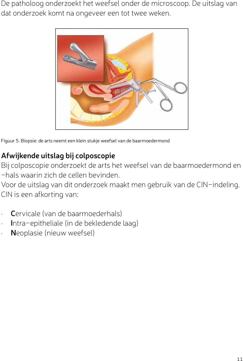 arts het weefsel van de baarmoedermond en -hals waarin zich de cellen bevinden.