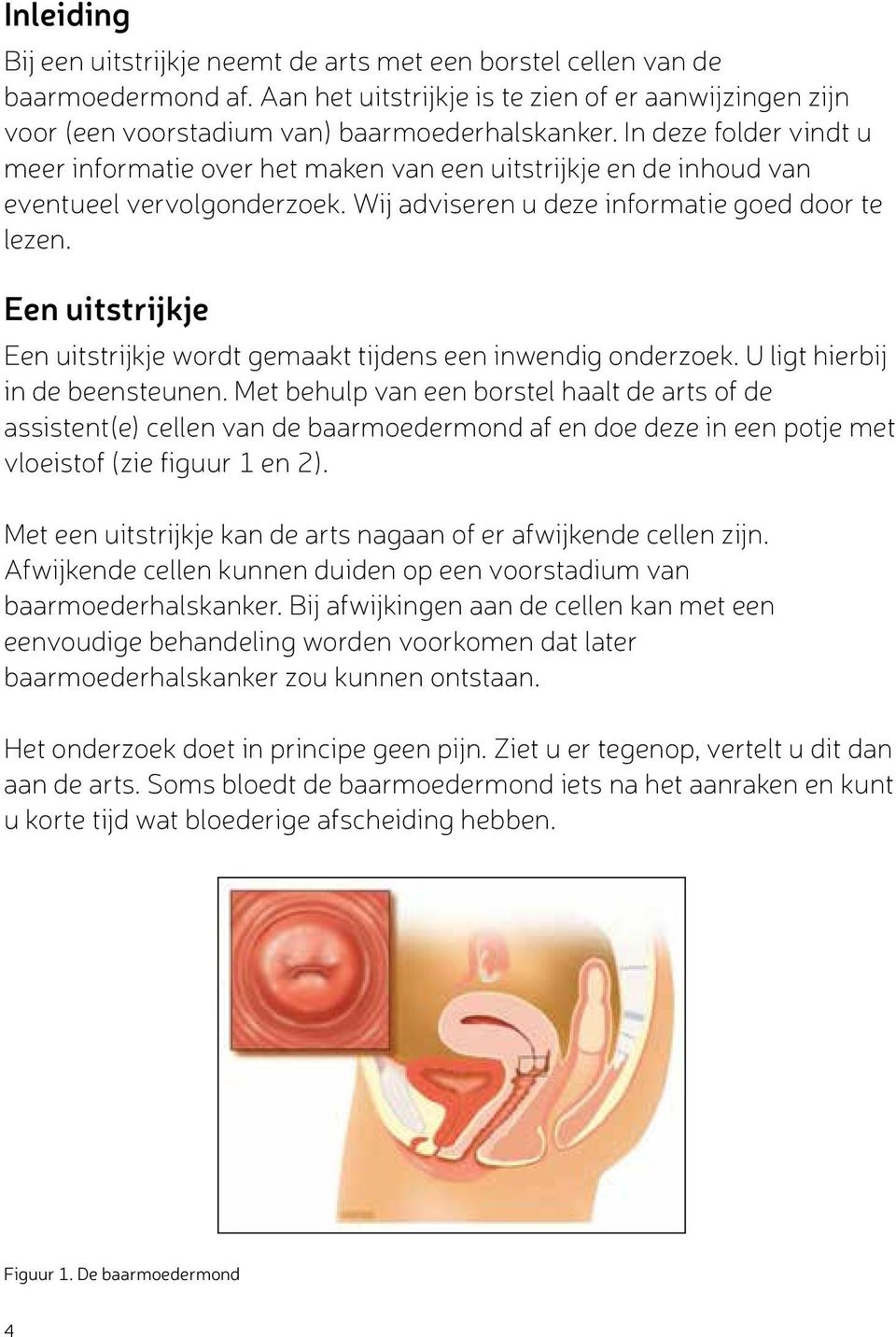 Een uitstrijkje Een uitstrijkje wordt gemaakt tijdens een inwendig onderzoek. U ligt hierbij in de beensteunen.