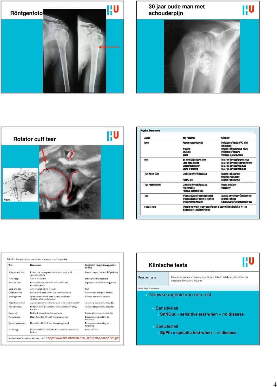 sensitive test when r/o disease http://www.hta.nhsw