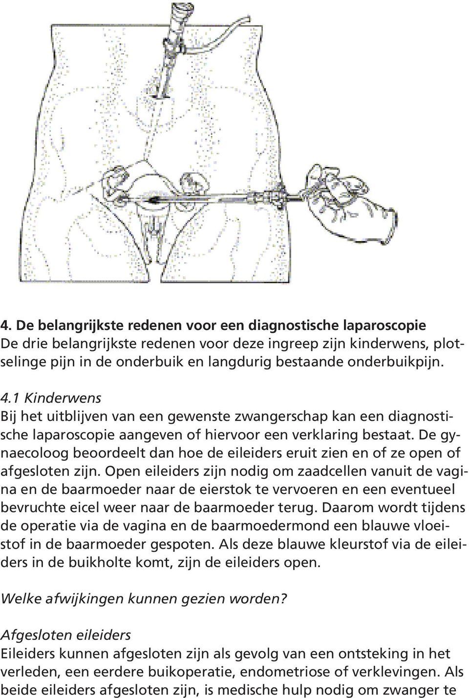 De gynaecoloog beoordeelt dan hoe de eileiders eruit zien en of ze open of afgesloten zijn.