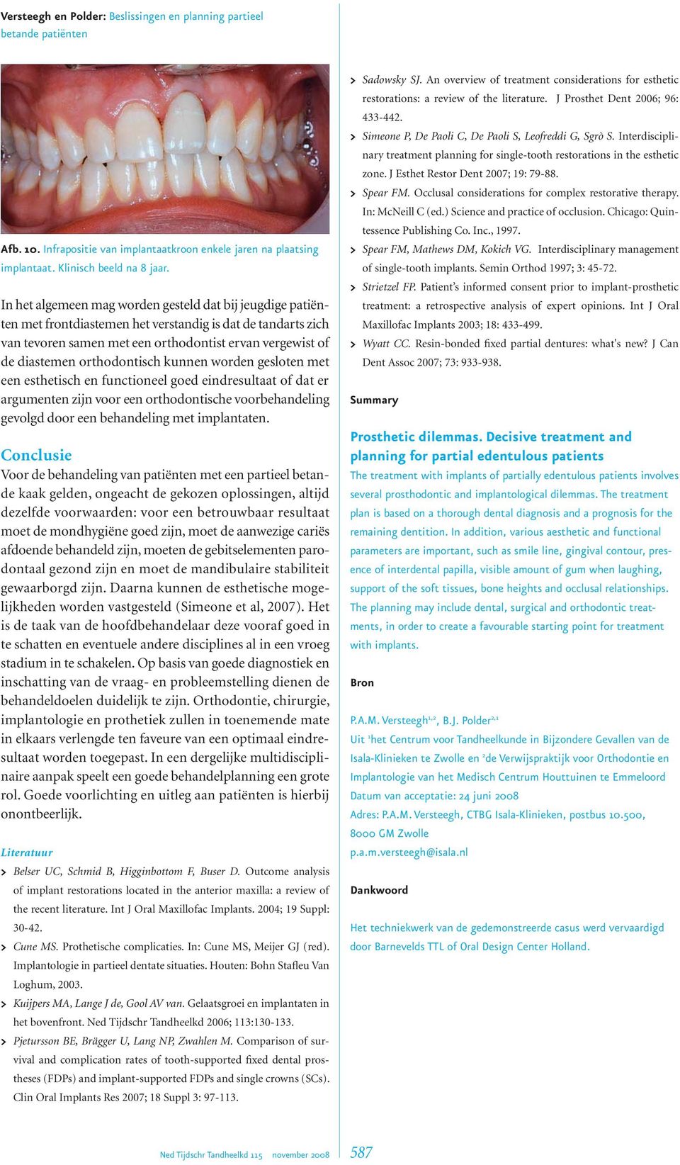 orthodontisch kunnen worden gesloten met een esthetisch en functioneel goed eindresultaat of dat er argumenten zijn voor een orthodontische voorbehandeling gevolgd door een behandeling met