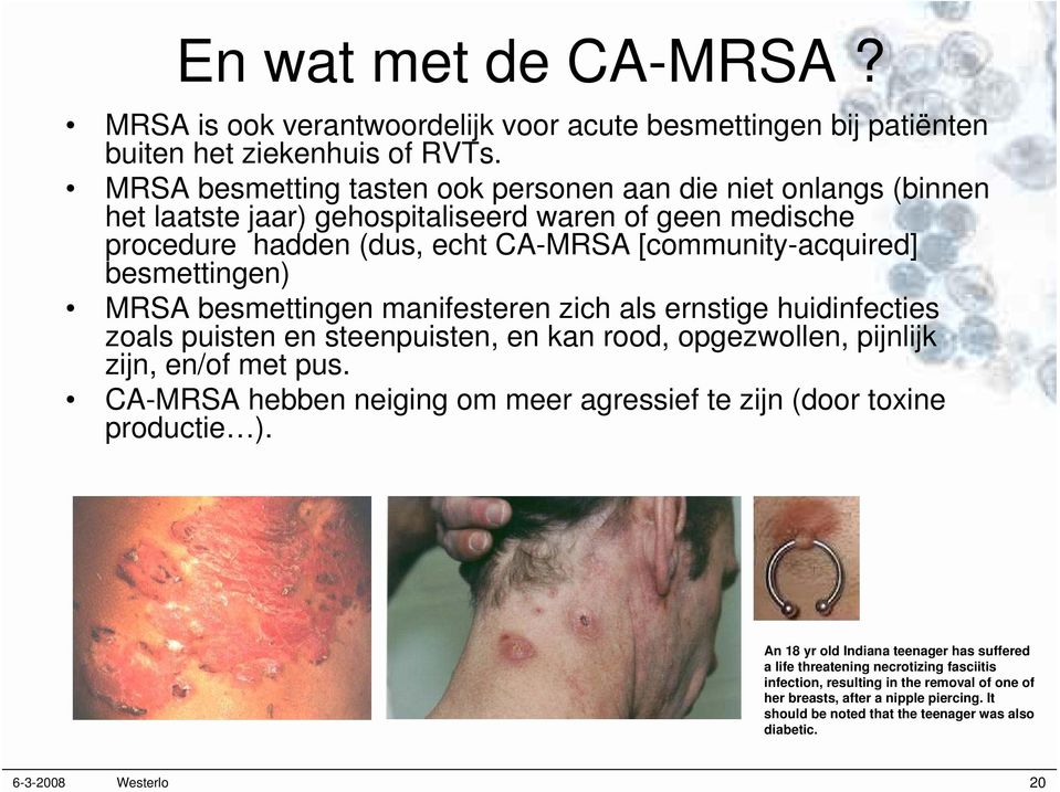 MRSA besmettingen manifesteren zich als ernstige huidinfecties zoals puisten en steenpuisten, en kan rood, opgezwollen, pijnlijk zijn, en/of met pus.