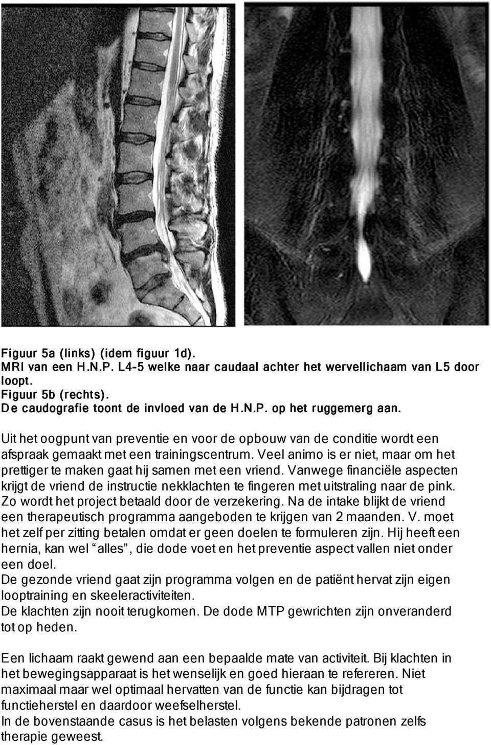 Veel animo is er niet, maar om het prettiger te maken gaat hij samen met een vriend. Vanwege financiële aspecten krijgt de vriend de instructie nekklachten te fingeren met uitstraling naar de pink.