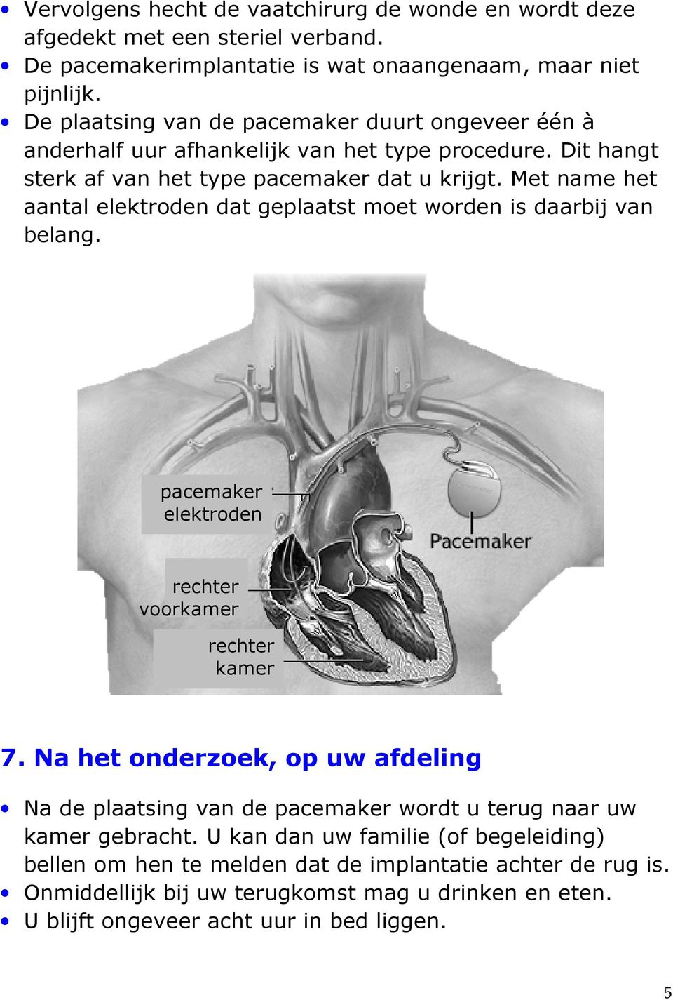 Met name het aantal elektroden dat geplaatst moet worden is daarbij van belang. pacemaker elektroden rechter voorkamer rechter kamer 7.