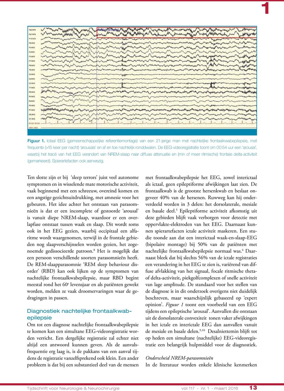 De EEG-videoregistratie toont om :54 uur een arousal, waarbij het tracé van het EEG verandert van NREM-slaap naar diffuse attenuatie en (min of meer ritmische) frontale delta-activiteit (gemarkeerd).