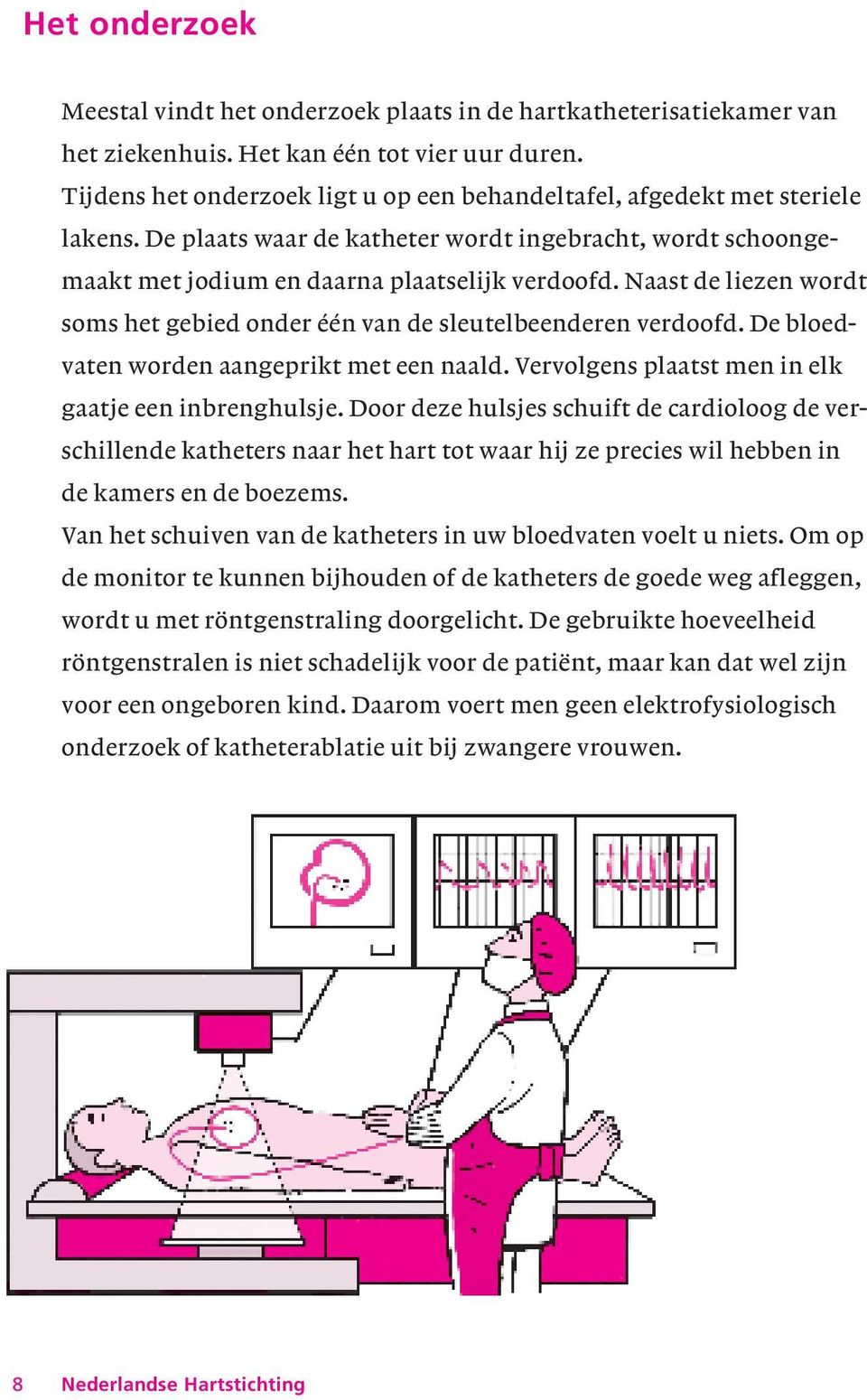 Naast de liezen wordt soms het gebied onder één van de sleutelbeenderen verdoofd. De bloedvaten worden aangeprikt met een naald. Vervolgens plaatst men in elk gaatje een inbrenghulsje.