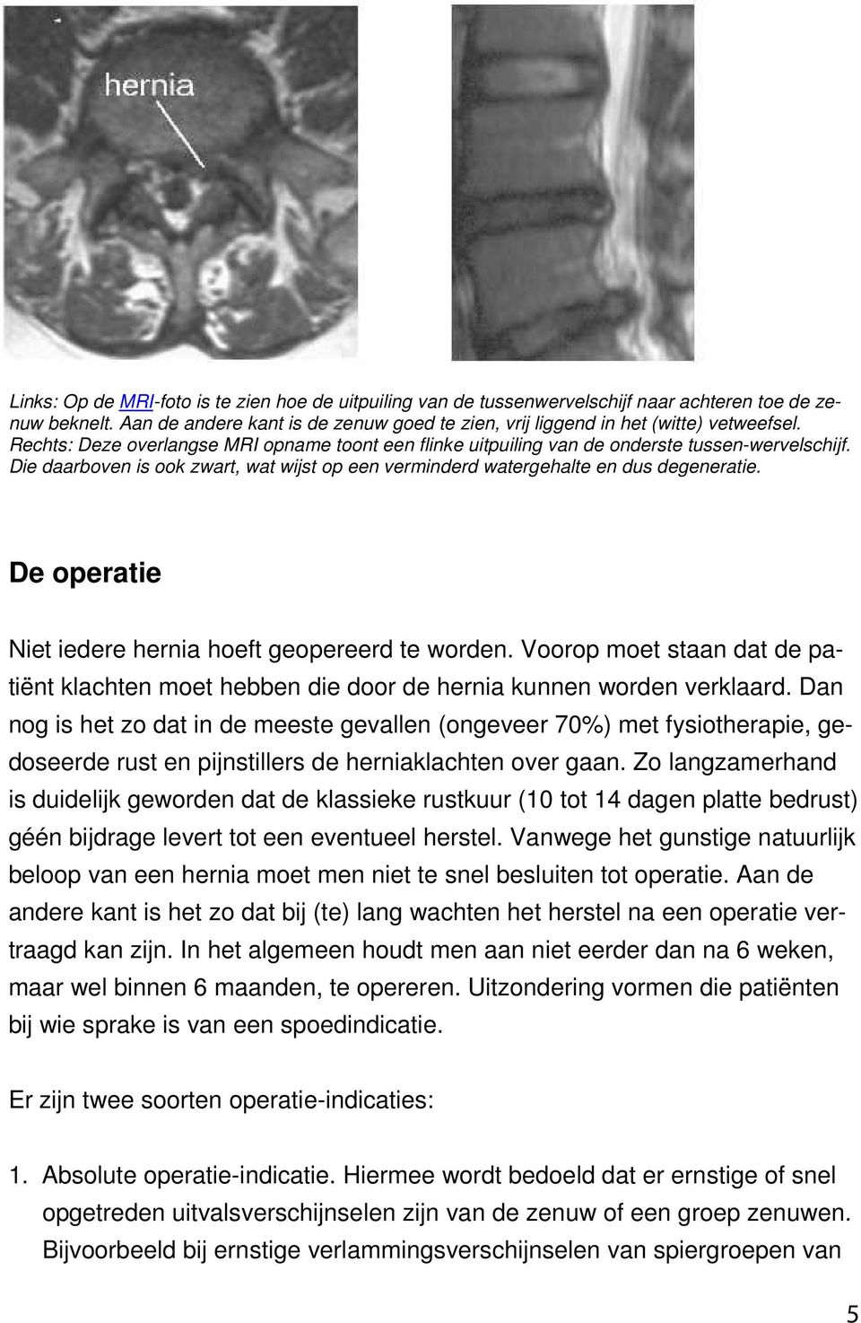 De operatie Niet iedere hernia hoeft geopereerd te worden. Voorop moet staan dat de patiënt klachten moet hebben die door de hernia kunnen worden verklaard.