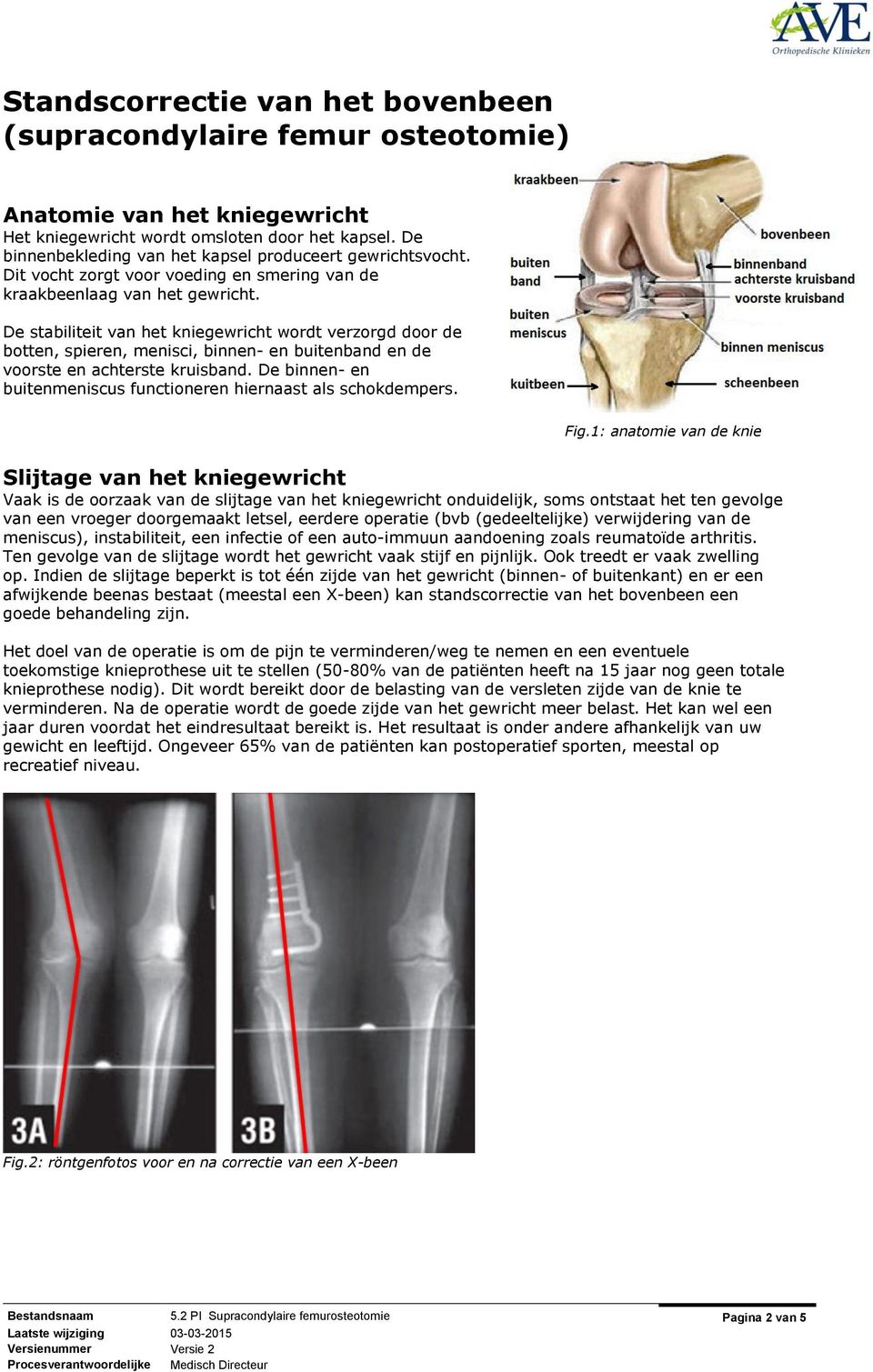 De stabiliteit van het kniegewricht wordt verzorgd door de botten, spieren, menisci, binnen- en buitenband en de voorste en achterste kruisband.