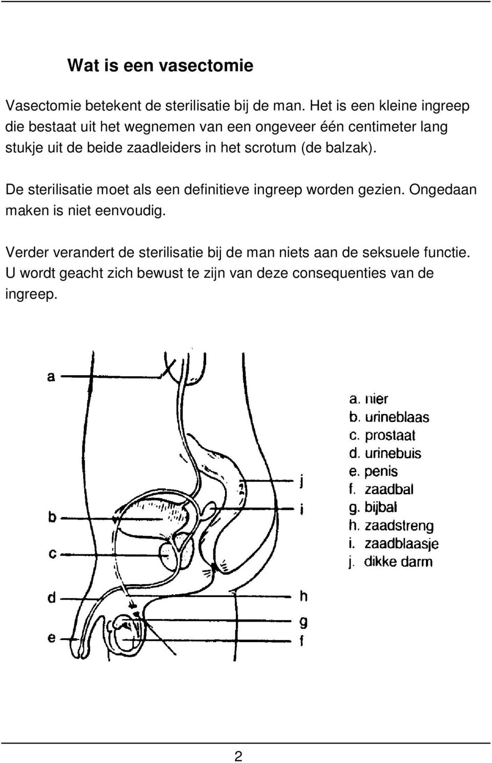 zaadleiders in het scrotum (de balzak). De sterilisatie moet als een definitieve ingreep worden gezien.