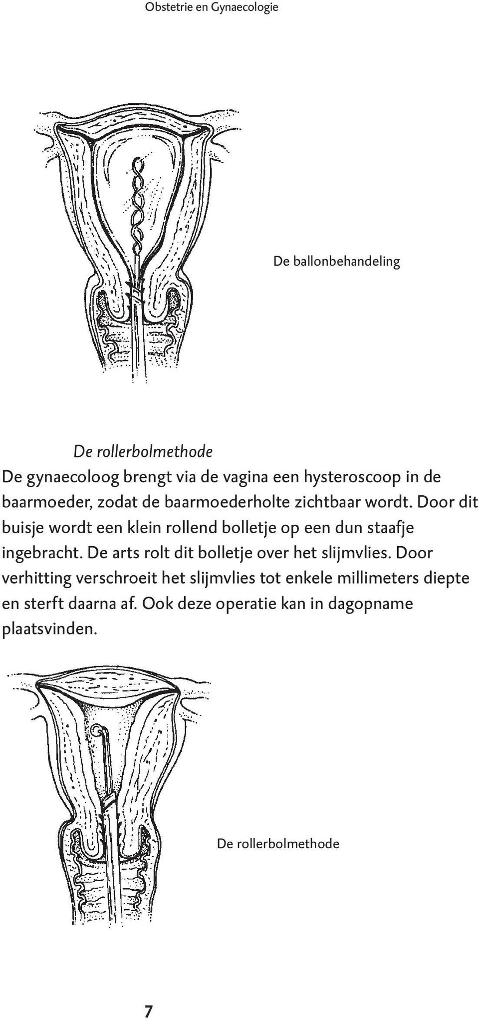 Door dit buisje wordt een klein rollend bolletje op een dun staafje ingebracht.