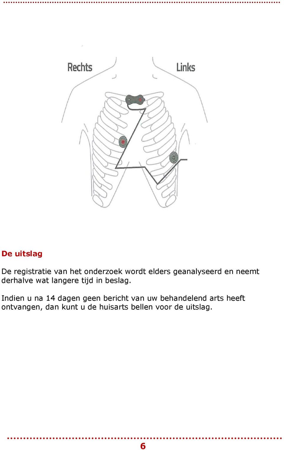 Indien u na 14 dagen geen bericht van uw behandelend arts