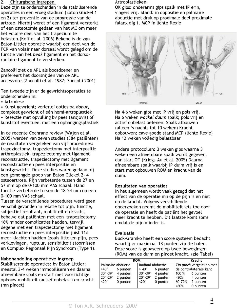 2006) Bekend is de zgn Eaton-Littler operatie waarbij een deel van de FCR van volair naar dorsaal wordt gelegd om de functie van het beak ligament en het dorsoradiaire ligament te versterken.