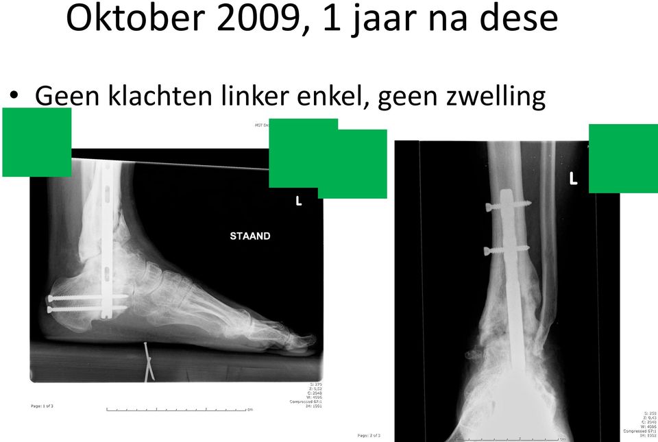 39 YEAR ST Enschede Haaksbergerstraat 01 Enkel links 02-10-2009 14:32:42 356666171 Page: 1 of 3