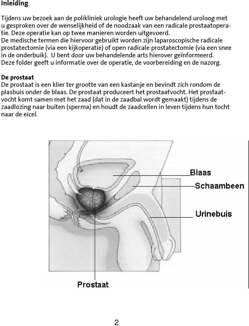 De medische termen die hiervoor gebruikt worden zijn laparoscopische radicale prostatectomie (via een kijkoperatie) of open radicale prostatectomie (via een snee in de onderbuik).