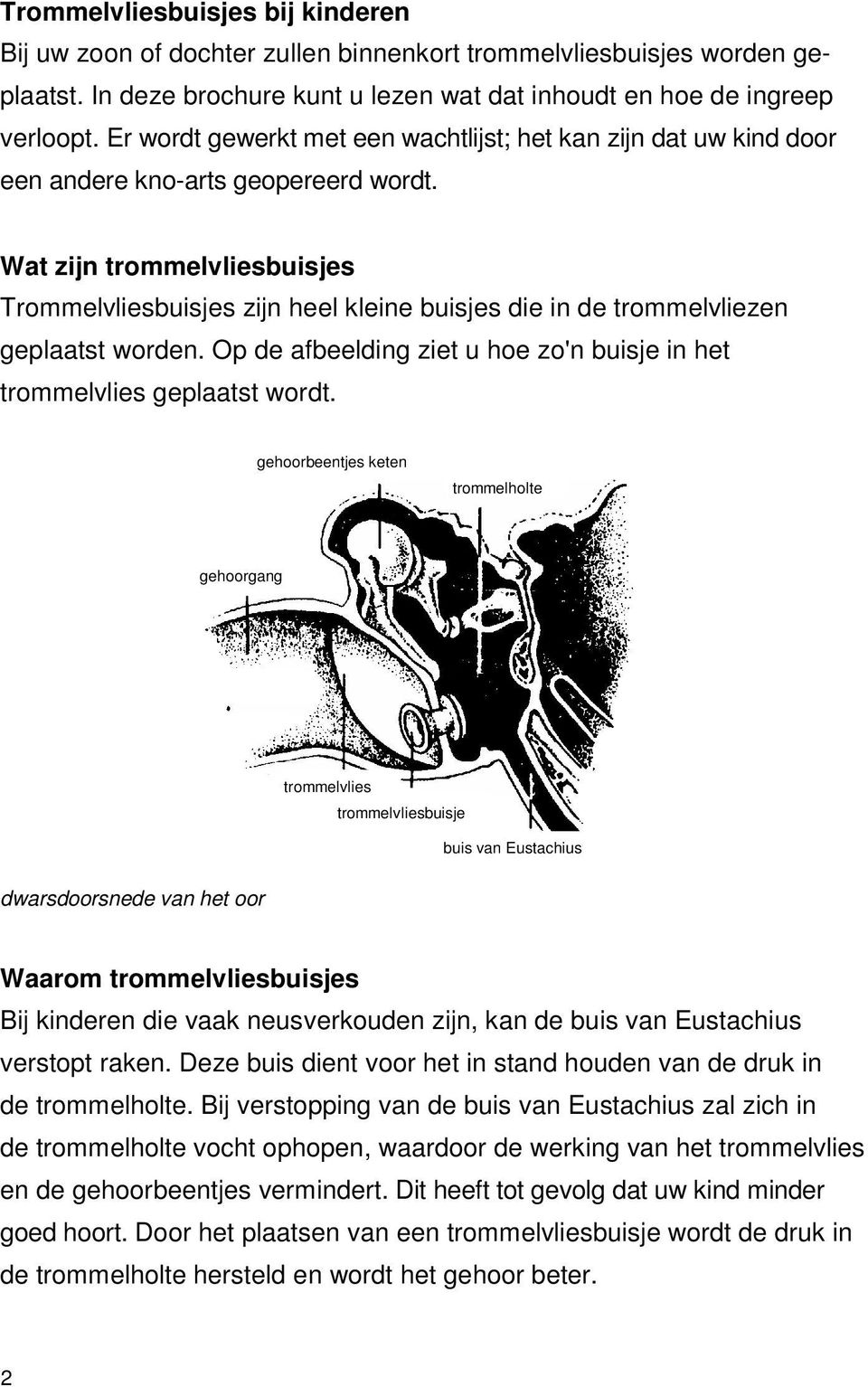 Wat zijn trommelvliesbuisjes Trommelvliesbuisjes zijn heel kleine buisjes die in de trommelvliezen geplaatst worden. Op de afbeelding ziet u hoe zo'n buisje in het trommelvlies geplaatst wordt.