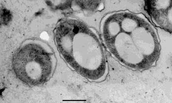 Poly-b-hydroxyalkanoate (PHA) Common and widespread storage material in microorganisms (>90 genera of archaea and