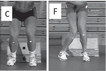 Risico op sportletsel is meetbaar Drop jump test (3d) KAM score