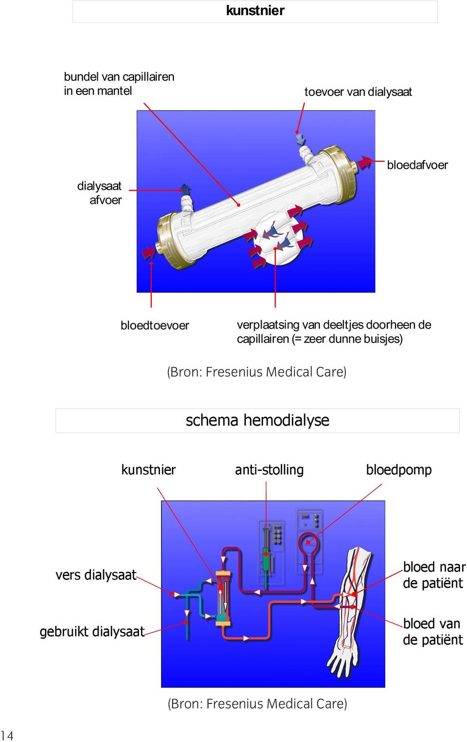 buisjes) (Bron: Fresenius Medical Care) schema hemodialyse kunstnier anti-stolling bloedpomp