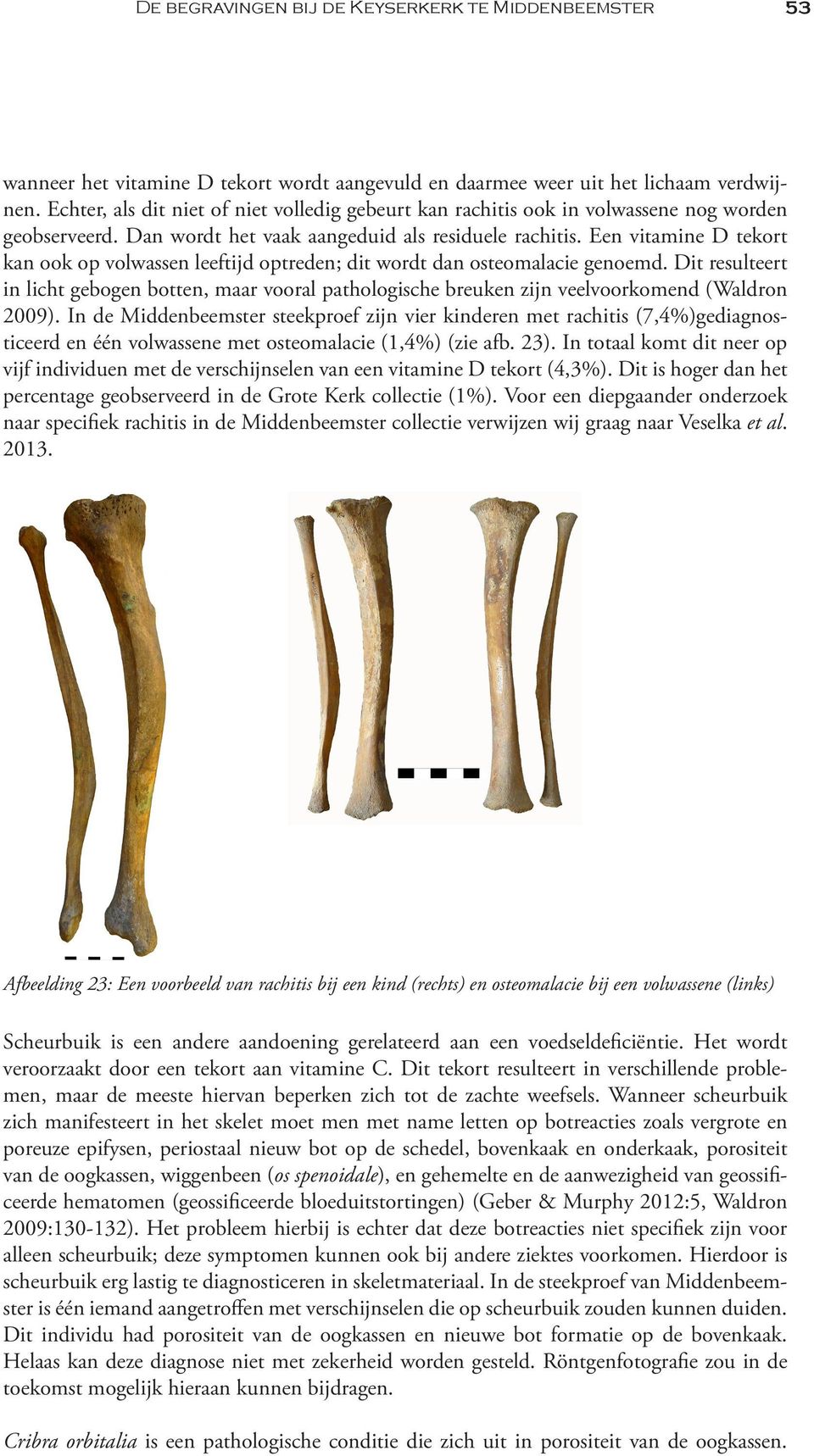 Een vitamine D tekort kan ook op volwassen leeftijd optreden; dit wordt dan osteomalacie genoemd.