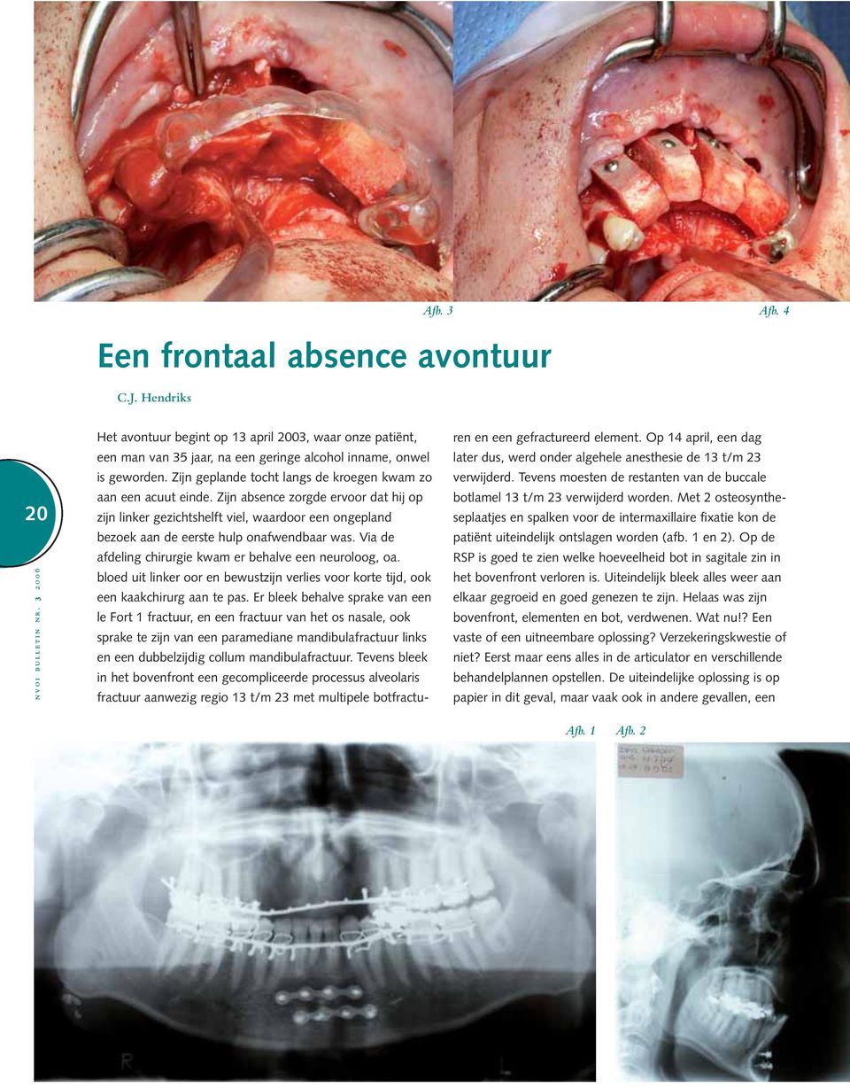 Zijn absence zorgde ervoor dat hij op zijn linker gezichtshelft viel, waardoor een ongepland bezoek aan de eerste hulp onafwendbaar was. Via de afdeling chirurgie kwam er behalve een neuroloog, oa.