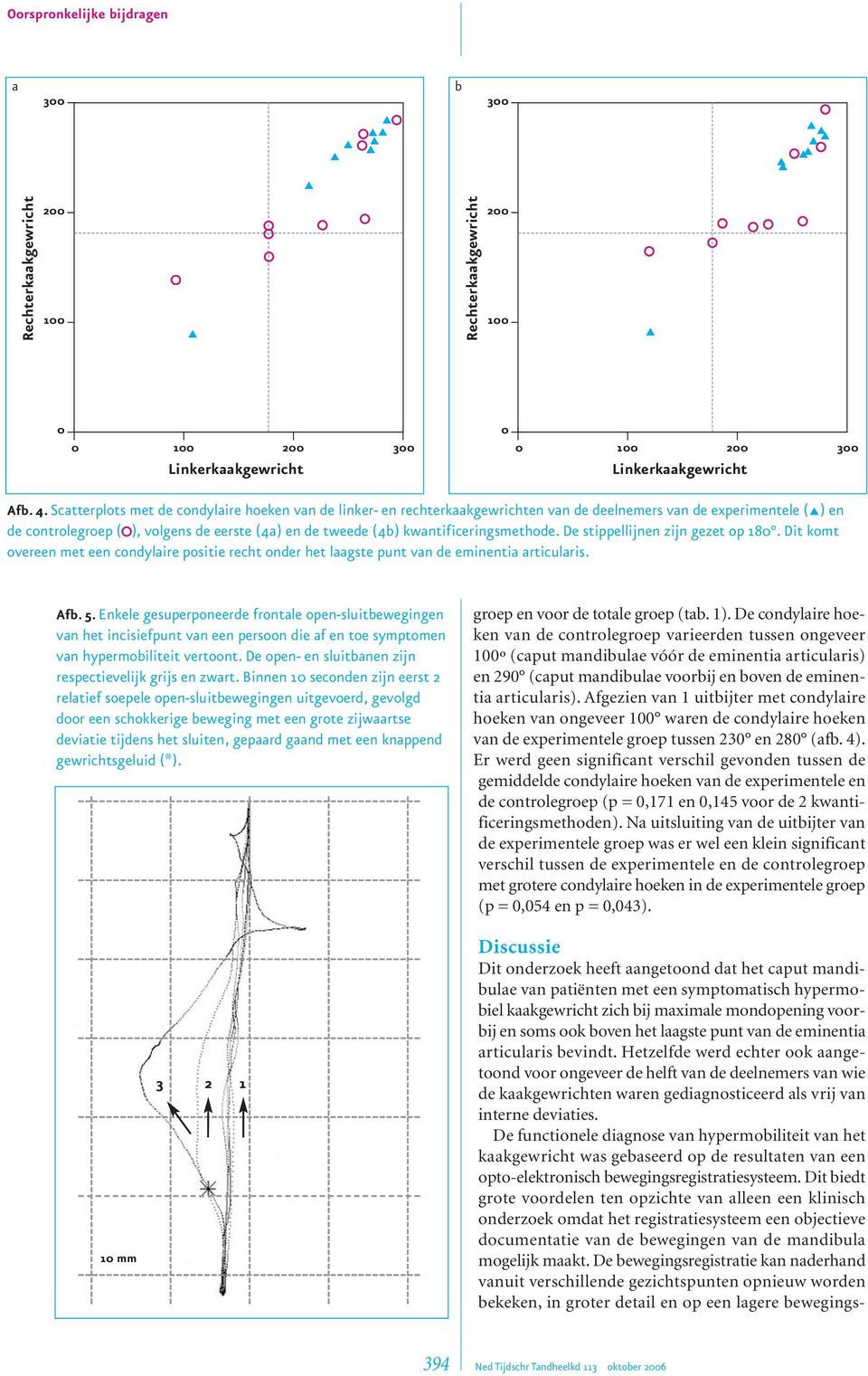 kwantificeringsmethode. De stippellijnen zijn gezet op 180. Dit komt overeen met een condylaire positie recht onder het laagste punt van de eminentia articularis. Afb. 5.