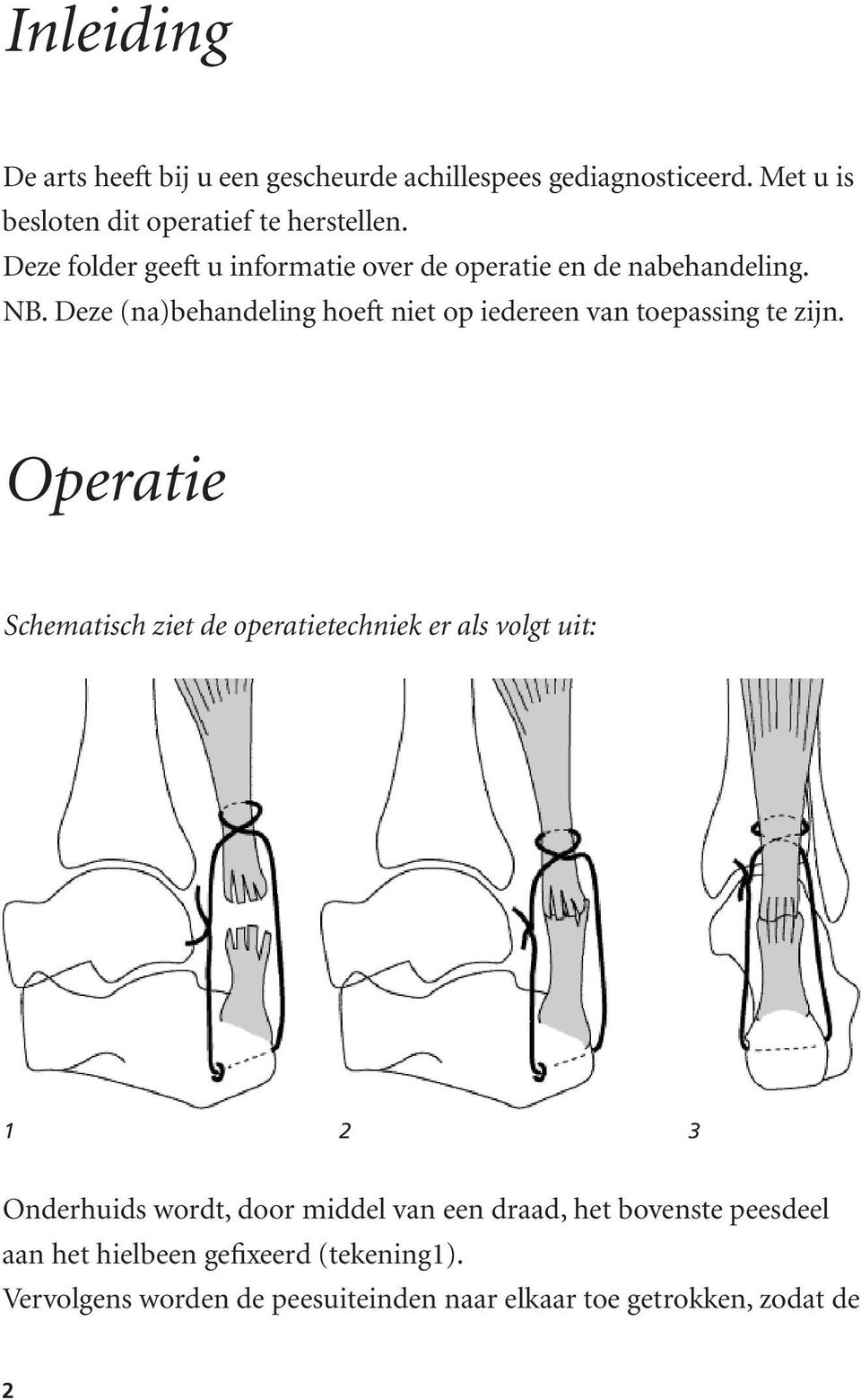 Deze (na)behandeling hoeft niet op iedereen van toepassing te zijn.