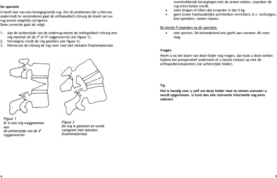 Vervolgens wordt de wig gesloten (zie figuur 2). 3. Hierna zet de chirurg de rug weer vast met metalen fixatiemateriaal.