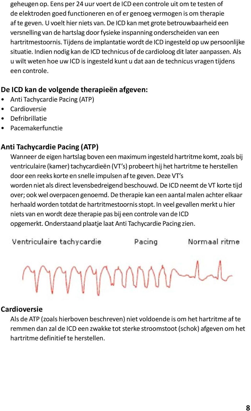 Tijdens de implantatie wordt de ICD ingesteld op uw persoonlijke situatie. Indien nodig kan de ICD technicus of de cardioloog dit later aanpassen.