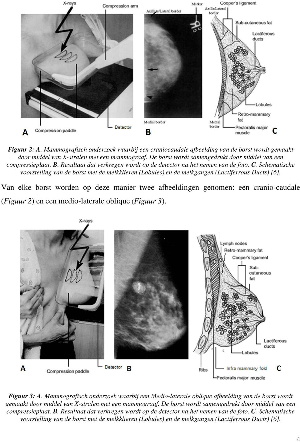 Schematische voorstelling van de borst met de melkklieren (Lobules) en de melkgangen (Lactiferrous Ducts) [6].