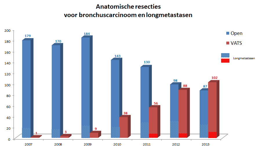 Leuven Overall > 400 VATS anatomical resections