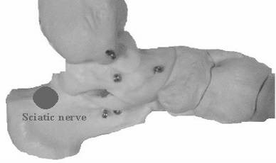 Fig.1. Fig. 2. Fig.3. Met zenuwreflexpunten kan je overal ingrijpen waar de neurotransmissie vererd is. Pijn ontstaat meestal tengevolge van disfuncties in het musculoskeletaal of visceraal apparaat.