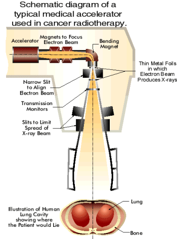 Lineaire versneller Linac Lineac Bij de huidige